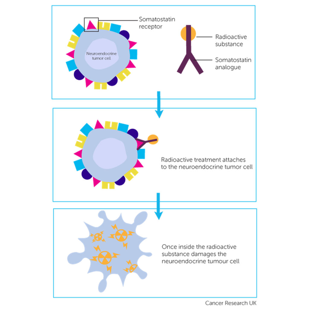 Medical Isotopespeptide Receptor Radionuclide Therapy Advancing Nuclear Medicine